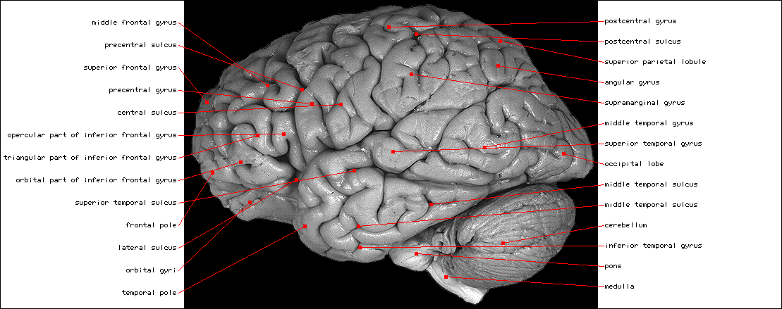 Left Hemisphere,Lateral View L.gif