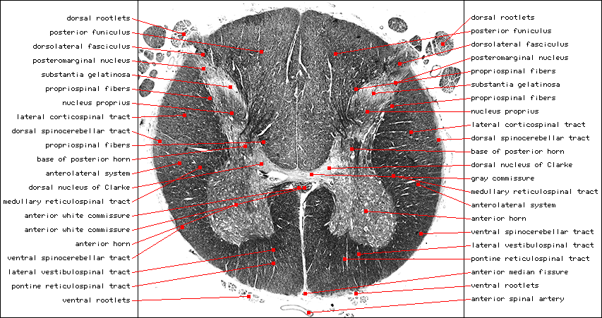 Lumbar Enlarg (L2), Weil L.gif