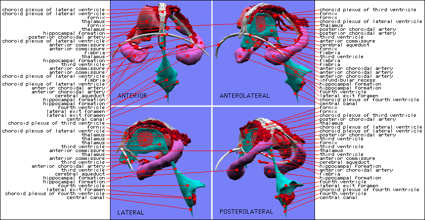Choroid Plexus Hippocampus Thalamus L.gif