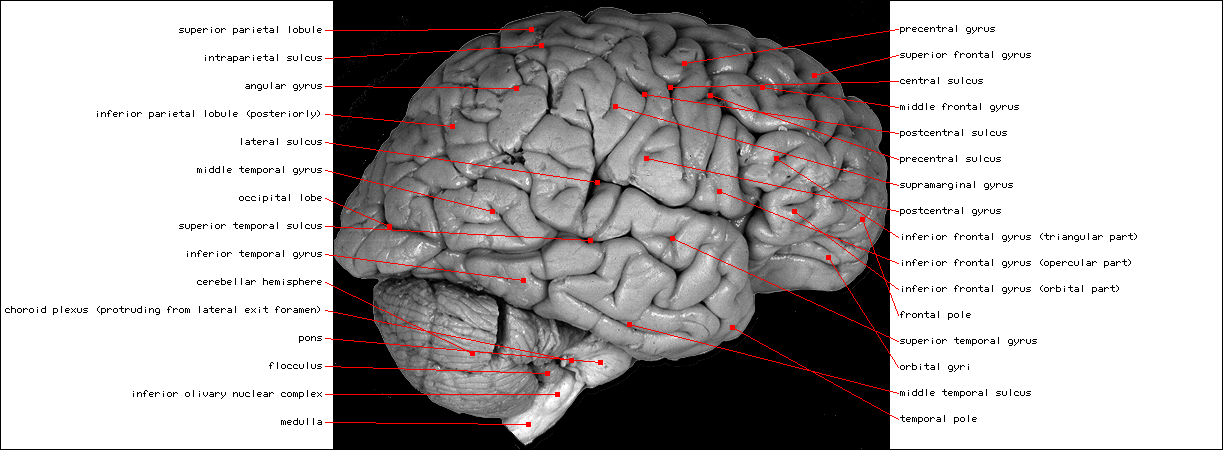 Right Hemisphere,Lateral View L.gif