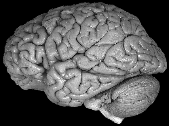 Left Hemisphere,Lateral View.gif