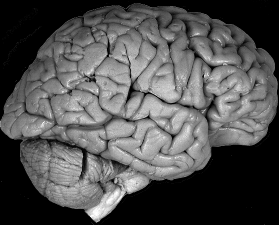 Right Hemisphere,Lateral View.gif