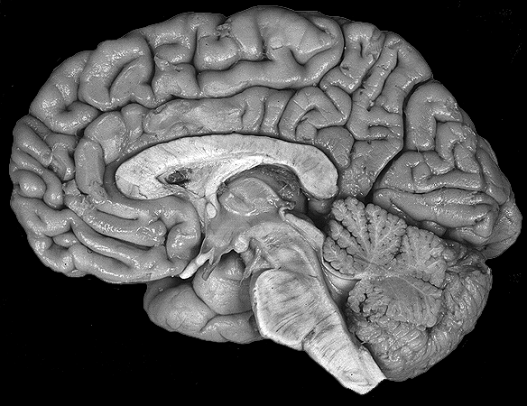 Right Hemisphere,Medial View 1.gif