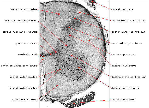 Lumbar Enlarg (L2), Nissl L.gif